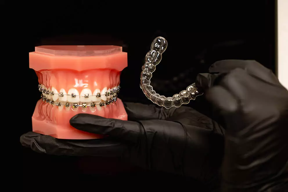 Teeth Straightening Teeth Straightening