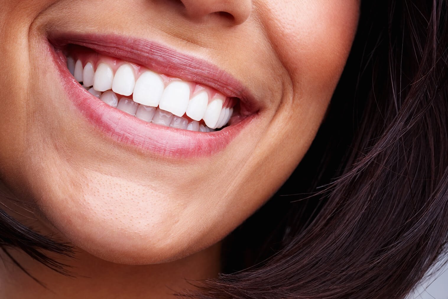 Veneers close up